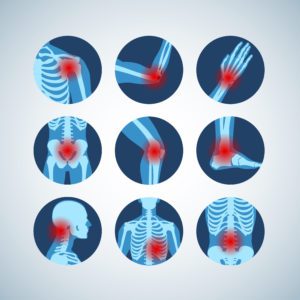 Services Main Page infographic inflamed joints